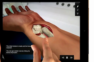 do interactive 3d medical animation, surgery explainer video