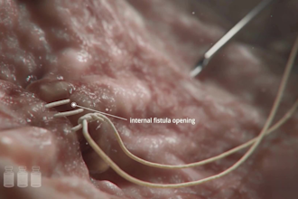 3d medical animation, surgery animation, vector illustration and medical video