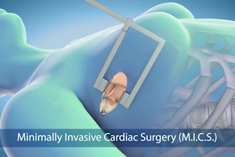 do 3d medical animation 3d anatomical animation 3d surgical animation 3d medical