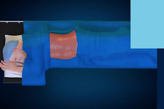 do 3d medical animation olif spine orthopedic surgery minimally explainer video