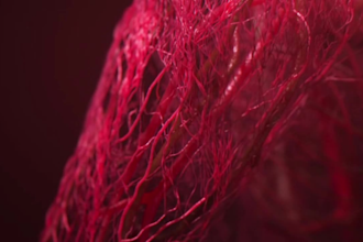 3d medical animation video, medical animation, surgery, 3d animation, medical