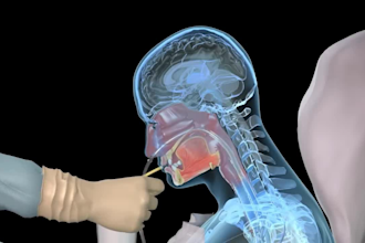 do high quality 3d medical animation video 3d explainer video surgical animation