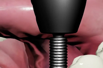 make 3d medical animated video