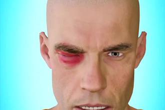create 3d medical animation services, 3d animation explainer medical videos