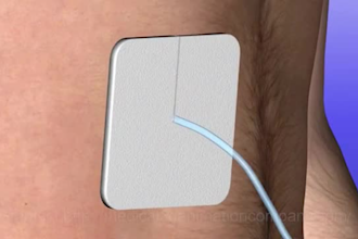 do 3d medical device animation 3d surgical device animation 3d medical explainer