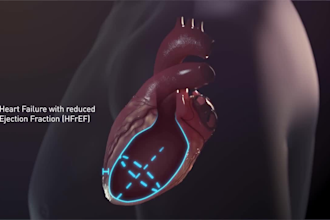 do 3d medical animation,3d surgery explainer video, 3d medical device animation