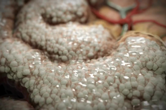 create 3d dental implant animation, medical video, and surgical procedure visual