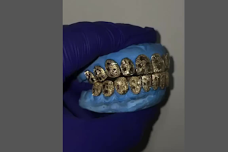 3d sculpt custom grillz and teeth jewelry design, 3d cad for casting or printing