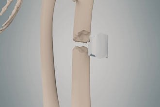 create 3d medical, surgical, and anatomy animations for healthcare videos