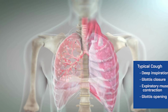 3d medical animation video, 3d dental 3d realistic animation and modeling