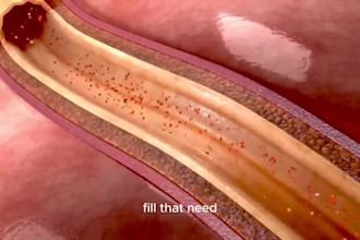 do 3d medical animation for a product or procedure illustration