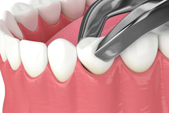 create 3d dental animation 3d surgery 3d medical animation and explainer video