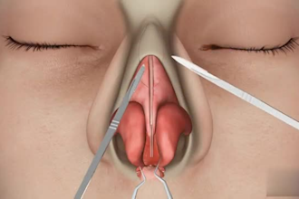 create an explainer 3d medical animation, 3d dental animation, medical animation