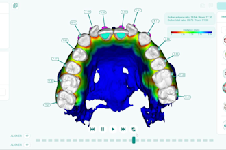 provide dental clear aligners treatment planning services
