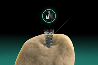 custom 3d medical surgery anatomy dental explainer video, implant medical device