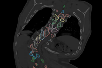 convert ct and mri images to 3d file