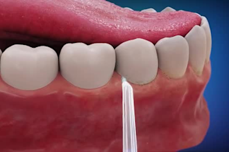 3d medical animation,3d medical equipment ,3d explainer scientific animation,cgi