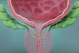 do clean medical 3d animation for surgery or anatomy