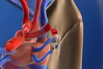 make quality 3d medical animation video surgery product scientific model anatomy