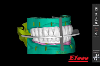 design new smiles in exocad