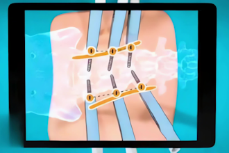 do 3d medical device animation 3d surgical device animation 3d medical explainer