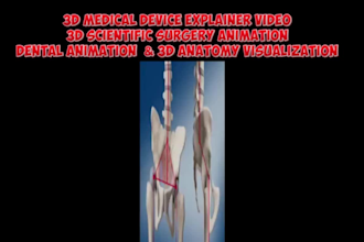 3d medical device explainer 3d scientific surgery animation dental 3d anatomy