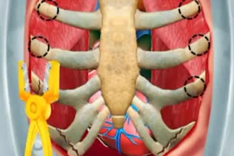 create professional 3d animation, medical animation, surgery