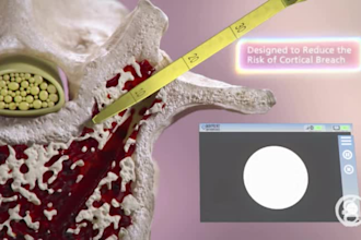 3d medical animation, medical animated, healthcare animation, 3d health video