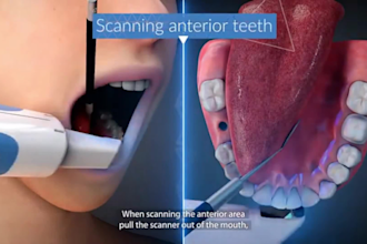 create 3d medical animation 3d dental animation 3d surgery animation