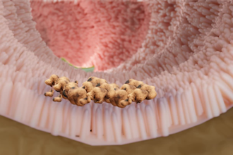 create surgery, medical animation, 3d medical animation video of high quality