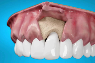 do 3d medical explainer video, anatomy, surgery, dental 3d product animation