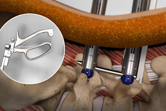 create high quality 3d medical animations and explainer videos