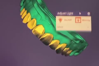 design dental prosthesis in exocad