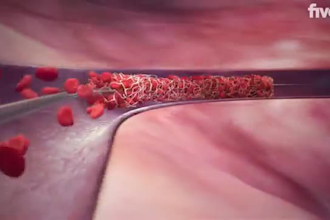 do 3d medical device animation 3d surgical device animation 3d medical explainer