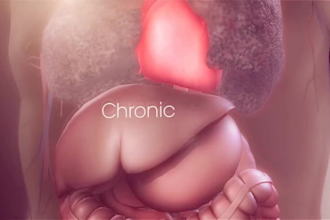 3d medical animation, medical video, 3d medical device and animation