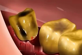 do transformative 3d teeth animation, dental animation,3d medical surgery