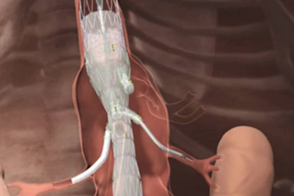 do 3d medical animation 3d product brush model 3d dental video video healthcare