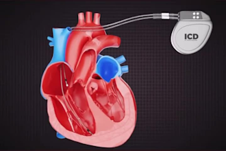 do 3d medical device animation, 3d medical video, surgical animation, technology