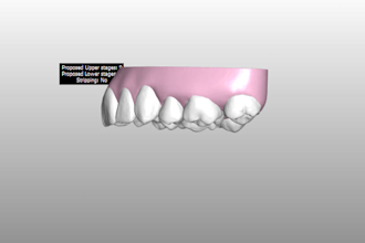 design clear aligner cases and retainers