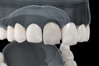 do 3d dental animation 3d medical animation 3d teeth animation 3d medical video