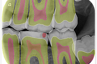 deliver a highly precised annotated dental radiograph