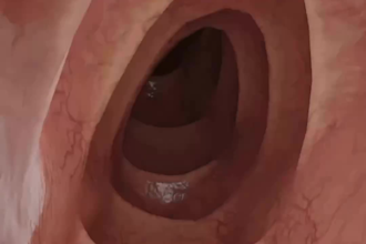do 3d medical animation 3d surgery animation with high quality rendering
