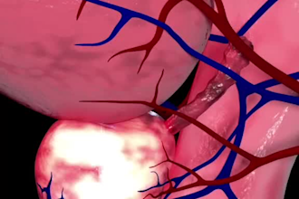 create high quality 3d medical animations for your product, procedure or concept