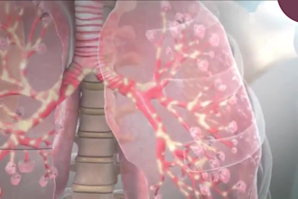 create 3d surgery animation 3d medical animation 3d medical explainer animation
