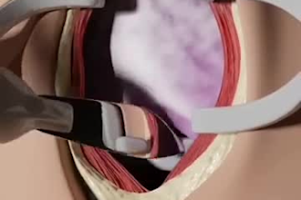 do 3d medical animation and 3d animation video