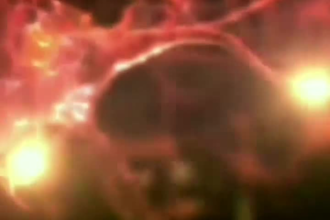 create 3d animation 3d medical animation medical animation anatomy