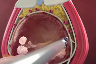 do 3d medical animation, explainer video, surgical procedure, device animation