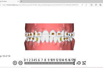 do dental clear aligner treatment planning on onyxceph