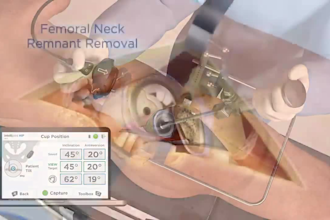 do 3d surgical anatomy medical device animated explainer video hospital blender