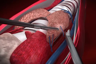 3d medical product animation video 3d surgery 3d health anatomy scientific video